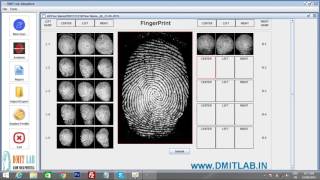 DMIT Software Training Fingerprint Scanning DMIT Lab India [upl. by Alius]