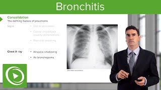 Bronchitis Consequences Symptoms amp Treatment – Respiratory Medicine  Lecturio [upl. by Eita]