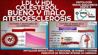 ATEROESCLEROSIS Y ARTERIOESCLEROSIS  GuiaMed [upl. by Ielarol]