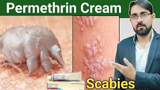 permethrin cream uses in hindi  scabies treatment in hindi  scabies permethrin cream Drx Rabbani [upl. by Gorman144]