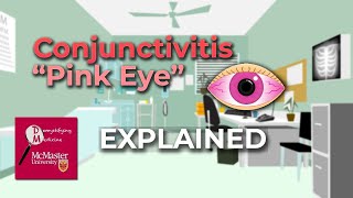 Conjunctivitis Pink Eye Explained [upl. by Mathew]