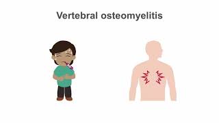 How to treat osteomyelitis [upl. by Imotas850]