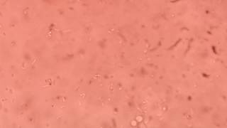 Listeria monocytogenes tumbling motility under microscope [upl. by Daryn]