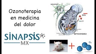 Ozonoterapia en medicina del dolor [upl. by Gerrit]