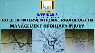 Interventional Radiology in biliary injury management Dr Rahul Sheth Safe cholecystectomy webinar [upl. by Annej]