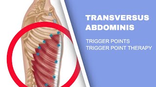 Abdominal Pain IBS and Trigger Points  An Overview [upl. by Gee]