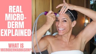 How Microdermabrasion Works  An In Depth Explanation of Professional Microdermbrasion [upl. by Mount]