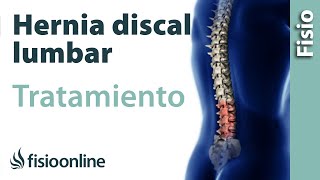 Hernia Discal Mejores Ejercicios Eliminar el Dolor Lumbar y la Ciática [upl. by Nnylrac442]