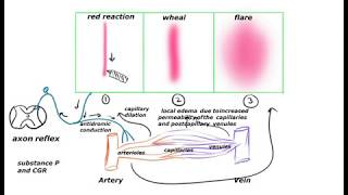 TRIPLE RESPONSE  Red reaction Wheal amp Flare [upl. by Fatimah108]