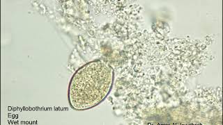 Diphyllobothrium latum egg [upl. by Hallam]