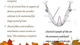 SUPPORT IN COMPLETE DENTURES [upl. by Madalyn]