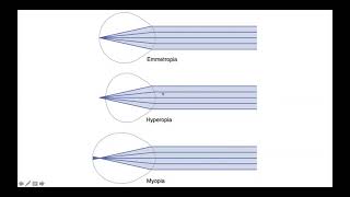 Emmetropia Hyperopia amp Myopia [upl. by Akcinehs]