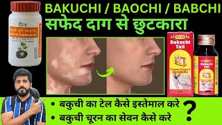 BAKUCHI OIL FOR VITILIGO  SBL BABCHI OIL KAISE KARE USE  PATANJALI BAKUCHI CHURAN  SAFED DAAG [upl. by Evvie876]