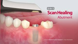 Scan Healing Abutment  Osstem Digital Workflow [upl. by Bledsoe839]