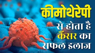 Cancer के लिए सबसे असरदार है Chemotherapy जानें कैसे होती है कीमो और इसके प्रकार [upl. by Lim802]