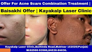 Offer For Acne Scars Combination Treatment  Baisakhi Offer  Kayakalp Laser Clinic [upl. by Stent]