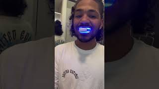 Teeth Whitening Review – Honest Thoughts amp Results [upl. by Ardnaeel]