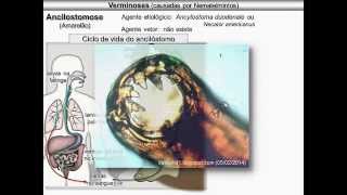 Verminoses causadas por nematelmintos [upl. by Fitz]