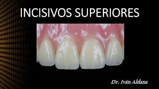 ANATOMÍA DENTARIA  Unidad 21 INCISIVOS SUPERIORES  DR IVÁN ALDANA [upl. by Aikemahs]