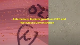 Enterococcus faecium Colony Morphology and Microscopy [upl. by Aciretnahs]