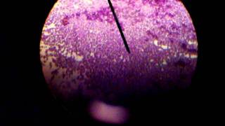 STAPHYLOCOCCUS EPIDERMIDISGRAM STAINED [upl. by Xever]