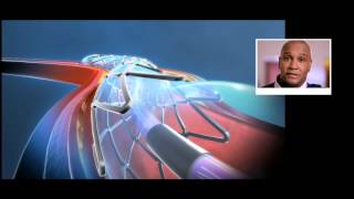 What is a stent and how does it work [upl. by Valeria]