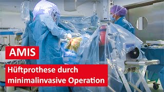 Hüftprothese durch minimalinvasive AMIS Methode  Live Operation [upl. by Adav248]