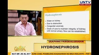 Hydronephrosis Swollen Kidney  Usapang Pangkalusugan [upl. by Eikciv]