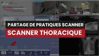 CT Scanner THORACIQUE Sans Injection  Partage de Pratiques [upl. by Anitsirk]