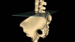 Anterior Innominate Rotation [upl. by Delilah364]