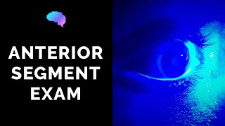 Anterior Segment Examination of the Eye  OSCE Guide  UKMLA  CPSA  PLAB 2 [upl. by Verge]