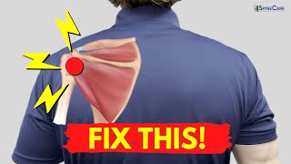 How to Fix Shoulder Snapping and Pop Sounds NO EQUIPMENT [upl. by Edmunda208]