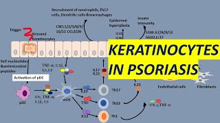 Psoriasis Pathogenesis Presenting the Key Role of Keratinocytes [upl. by Strep366]