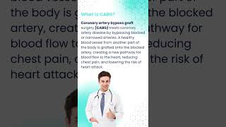 What is CABG LifeSaving Facts amp Everything You Need to Know About CABG Surgery [upl. by Yecak726]