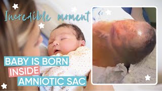 Incredible En Caul Birth  Channel Mum [upl. by Nwadahs]