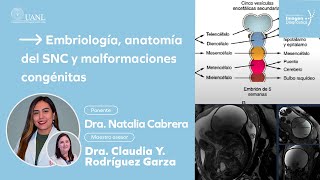 Embriología anatomía del SNC y malformaciones congénitas por la Dra Natalia Cabrera [upl. by Atlanta]