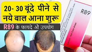 बस 2030 बूंदे पीने से नए बाल आना शुरू  R89 medicine for Hair Fall R89medicine [upl. by Tesil]