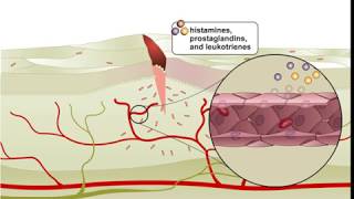 Inflammation Full Animation Video  ScienceRoot [upl. by Yttam745]