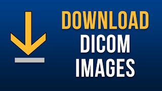 Where to Download DICOM Images [upl. by Darra]