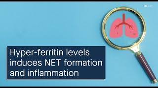 The role of excess ferritin in systemic inflammation and lung injury during sepsis [upl. by Ambrogino307]