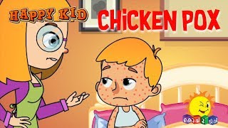 Happy Kid  Chicken Pox  Episode 41  Kochu TV  Malayalam [upl. by Asiole]