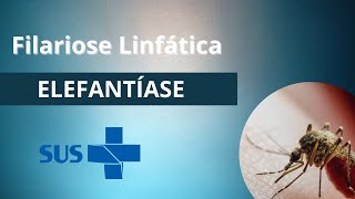 Filariose Linfática  elefantíase filaríase [upl. by Conan]