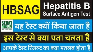 HBSAG Test Hepatitis B surface antigen test यह टेस्ट क्यों किया जाता है इस टेस्ट से क्या पता चलता है [upl. by Alag]