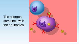 How Allergies Work Animation Understanding Allergic Reaction Immune System Video Symptom Treatment [upl. by Asante]