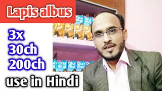 Lapis albus  3x30ch200ch use in hindi homeopathic medicine sign amp symptoms  use in tumors [upl. by Cirred]