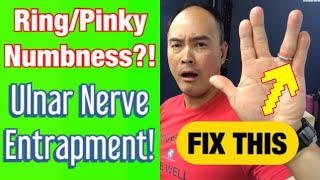 Ulnar Nerve Entrapment 4 Easy StretchesExercises For Relief  Dr Wil amp Dr K [upl. by Enej]