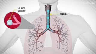 Asthma  signs and symptoms pathophysiology [upl. by Norri]