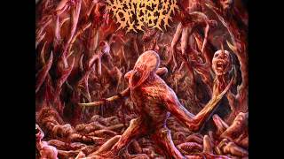 Disfigurement Of Flesh  Carnivorous Intestinal Worms [upl. by Ballman]