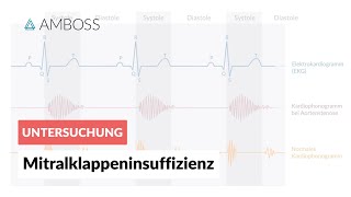 Mitralklappeninsuffizienz  Herzgeräusch  AMBOSS Video [upl. by Ellak]