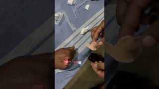 IV Cannula❤️🔥 20 number shortvideo shorts viralvideo music [upl. by Aivatan945]